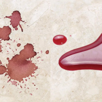 Просочення захисне Tenax Proseal 5 л водо масло брудовідштовхувальне для натурального і штучного каменю Просочення захисне Tenax Proseal 5 л водо масло брудовідштовхувальне для натурального і штучного каменю